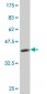 IL1A Antibody (monoclonal) (M01)