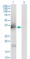 IL1A Antibody (monoclonal) (M01)