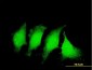 IL1B Antibody (monoclonal) (M01)