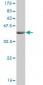 IL1B Antibody (monoclonal) (M01)