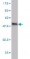 IL1F7 Antibody (monoclonal) (M06)