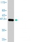 IL1RN Antibody (monoclonal) (M01)