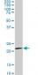 IL20 Antibody (monoclonal) (M01)