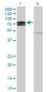 IL22RA1 Antibody (monoclonal) (M03)