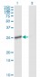 IL27 Antibody (monoclonal) (M01)