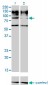 IL31RA Antibody (monoclonal) (M01)