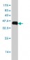 IL31RA Antibody (monoclonal) (M01)