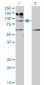 IL31RA Antibody (monoclonal) (M01)