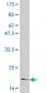 IL6 Antibody (monoclonal) (M01)