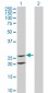 IL6 Antibody (monoclonal) (M01)