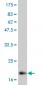 IL6 Antibody (monoclonal) (M08)