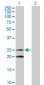 IL6 Antibody (monoclonal) (M08)