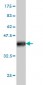 IL6R Antibody (monoclonal) (M01)