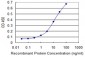 IL6ST Antibody (monoclonal) (M02)