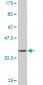 IL6ST Antibody (monoclonal) (M02)