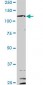 IL6ST Antibody (monoclonal) (M02)