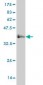 IL6ST Antibody (monoclonal) (M05)