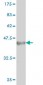 ILF2 Antibody (monoclonal) (M01)