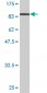 IMP-3 Antibody (monoclonal) (M01)