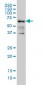 IMP-3 Antibody (monoclonal) (M01)