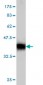 IMPDH1 Antibody (monoclonal) (M01)