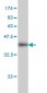 IQGAP2 Antibody (monoclonal) (M01)