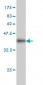 IQGAP2 Antibody (monoclonal) (M01)