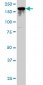 IQGAP2 Antibody (monoclonal) (M01)