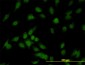 IRAK1 Antibody (monoclonal) (M01)