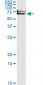 IRAK1 Antibody (monoclonal) (M01)