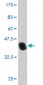 IRAK1 Antibody (monoclonal) (M01)