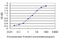 IRAK1 Antibody (monoclonal) (M01)
