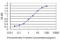 IRAK1 Antibody (monoclonal) (M01)