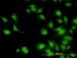 IRAK1 Antibody (monoclonal) (M02)