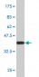IRAK1 Antibody (monoclonal) (M02)