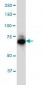 IRAK1 Antibody (monoclonal) (M02)