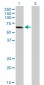 IRAK1 Antibody (monoclonal) (M02)