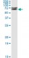 IRAK1 Antibody (monoclonal) (M02)