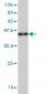 IRF4 Antibody (monoclonal) (M02)