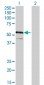 IRF4 Antibody (monoclonal) (M02)