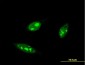 IRF4 Antibody (monoclonal) (M05)