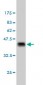 IRF5 Antibody (monoclonal) (M03)