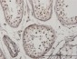 IRF5 Antibody (monoclonal) (M05)