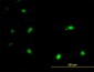 IRX3 Antibody (monoclonal) (M03)