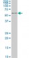 IRX3 Antibody (monoclonal) (M03)