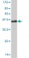 IRX3 Antibody (monoclonal) (M08)