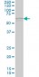 IRX3 Antibody (monoclonal) (M08)