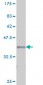 ITGA2 Antibody (monoclonal) (M01)