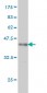 ITGA9 Antibody (monoclonal) (M01)