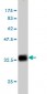ITGB2 Antibody (monoclonal) (M01)
